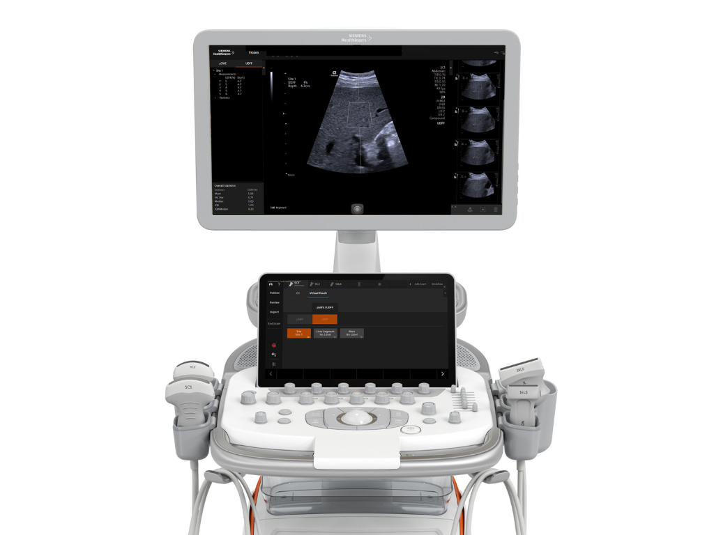 Siemens Healthineers ACUSON Redwood ultrasound system